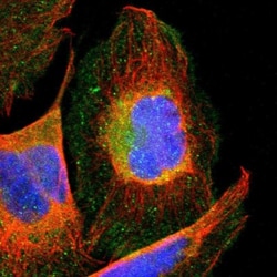 CCT3 Antibody, Novus Biologicals 0.1mL; Unlabeled:Antibodies, Polyclonal