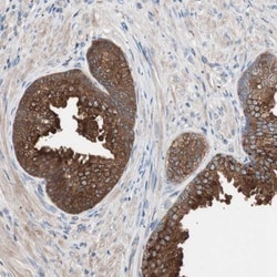 CCT3 Antibody, Novus Biologicals 0.1mL; Unlabeled:Antibodies, Polyclonal