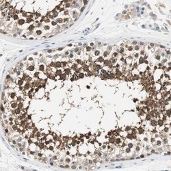 CCT5 Antibody, Novus Biologicals 25 &mu;L; Unlabeled:Antibodies, Polyclonal