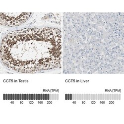 CCT5 Antibody, Novus Biologicals 25 &mu;L; Unlabeled:Antibodies, Polyclonal