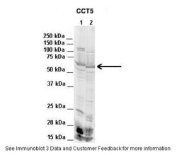 CCT5 Antibody, Novus Biologicals 100 &mu;L | Buy Online | Novus Biologicals | Fisher Scientific
