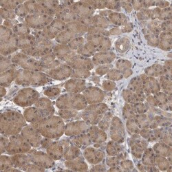 CCT8 Antibody, Novus Biologicals 25 &mu;L; Unlabeled:Antibodies, Polyclonal