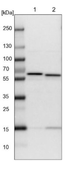 CCT8 Antibody, Novus Biologicals 25 &mu;L; Unlabeled:Antibodies, Polyclonal