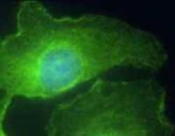 CD-M6PR Antibody, Novus Biologicals 0.05mg; Unlabeled:Antibodies, Polyclonal