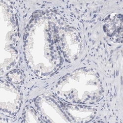 CD117/c-kit Antibody, Novus Biologicals 25 &mu;L | Buy Online | Novus Biologicals | Fisher Scientific