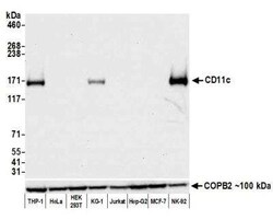 CD11c Antibody (BLR138H), Novus Biologicals 100 &mu;g | Buy Online | Novus Biologicals | Fisher Scientific