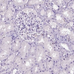 CD11c Antibody (CL1831), Novus Biologicals 25 &mu;L, Unlabeled:Antibodies,