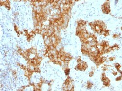 CD11c Antibody (ITGAX/1243), Novus Biologicals 0.2mg; Unlabeled:Antibodies,