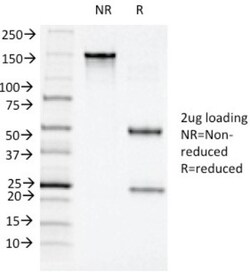 CD11c Antibody (ITGAX/1243), Novus Biologicals 0.2mg; Unlabeled:Antibodies,