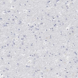 CD11c Antibody, Novus Biologicals 25 &mu;L; Unlabeled:Antibodies, Polyclonal