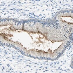 CD133 Antibody, Novus Biologicals 100uL; Unlabeled:Antibodies, Polyclonal