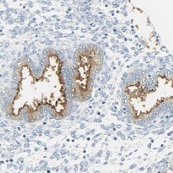 CD133 Antibody, Novus Biologicals 100uL; Unlabeled:Antibodies, Polyclonal