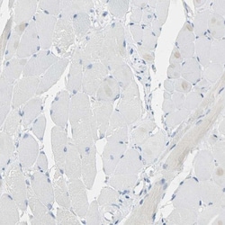 CD133 Antibody, Novus Biologicals 100uL; Unlabeled:Antibodies, Polyclonal