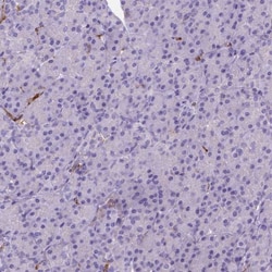 CD14 Antibody (CL1637), Novus Biologicals 0.1mL; Unlabeled:Antibodies,
