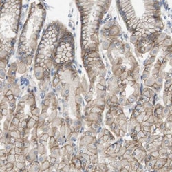 CD155/PVR Antibody, Novus Biologicals:Antibodies:Primary Antibodies