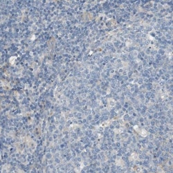 CD155/PVR Antibody, Novus Biologicals:Antibodies:Primary Antibodies