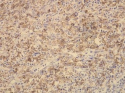 CD163 Antibody (K20-T), Novus Biologicals 0.1mL; Unlabeled:Antibodies,