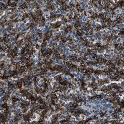 RRP7A Antibody, Novus Biologicals:Antibodies:Primary Antibodies