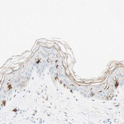 CD1a Antibody, Novus Biologicals 0.1mL; Unlabeled:Antibodies, Polyclonal