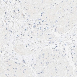 CD1a Antibody, Novus Biologicals:Antibodies:Primary Antibodies
