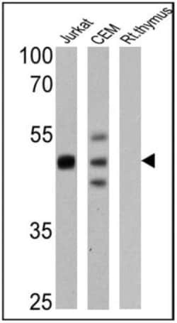 CD2 Antibody (TS2/18) - Azide and BSA Free, Novus Biologicals 50 &mu;g,