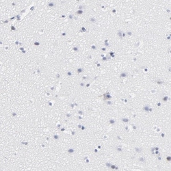 CD2 Antibody, Novus Biologicals 0.1mL; Unlabeled:Antibodies, Polyclonal
