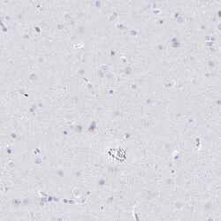 CD21 Antibody, Novus Biologicals:Anticorps:Anticorps primaires