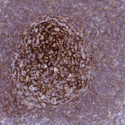 CD21 Antibody, Novus Biologicals 0.1mL; Unlabeled:Antibodies, Polyclonal