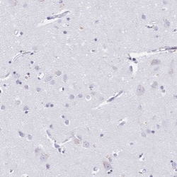 CD21 Antibody, Novus Biologicals 0.1mL; Unlabeled:Antibodies, Polyclonal