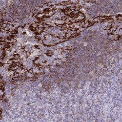 CD21 Antibody, Novus Biologicals 0.1mL; Unlabeled:Antibodies, Polyclonal