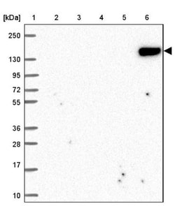 CD21 Antibody, Novus Biologicals 0.1mL; Unlabeled:Antibodies, Polyclonal