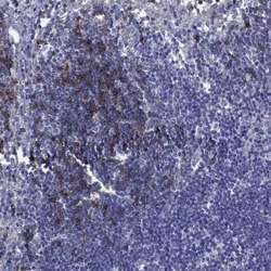 CD23/Fc epsilon RII Rabbit anti-Human, Polyclonal, Novus Biologicals:Antibodies:Primary