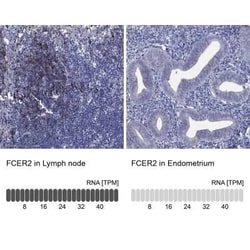 CD23/Fc epsilon RII Rabbit anti-Human, Polyclonal, Novus Biologicals:Antibodies:Primary
