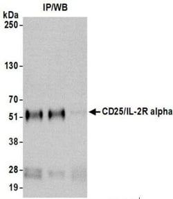 CD25/IL-2R alpha Antibody (BLR157J), Novus Biologicals 100 &mu;g | Buy Online | Novus Biologicals | Fisher Scientific