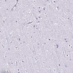 CD27/TNFRSF7 Antibody, Novus Biologicals:Antibodies:Primary Antibodies