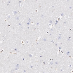 CD2AP Antibody, Novus Biologicals:Antibodies:Primary Antibodies