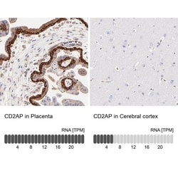 CD2AP Antibody, Novus Biologicals:Antibodies:Primary Antibodies