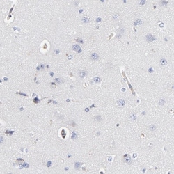 CD2AP Antibody, Novus Biologicals 0.1mL; Unlabeled:Antibodies, Polyclonal