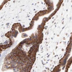 CD2AP Antibody, Novus Biologicals 0.1mL; Unlabeled:Antibodies, Polyclonal