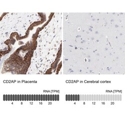 CD2AP Antibody, Novus Biologicals 0.1mL; Unlabeled:Antibodies, Polyclonal