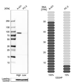 CD2AP Antibody, Novus Biologicals:Antibodies:Primary Antibodies