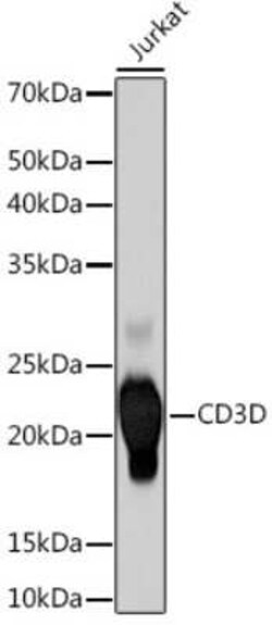 CD3 delta Rabbit anti-Human, Mouse, Rat, Clone: 2R1O10, Novus Biologicals 100 &mu;g | Buy Online | Bio-Techne | Fisher Scientific