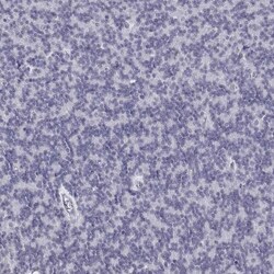 CD3 epsilon Antibody, Novus Biologicals 0.1mL; Unlabeled:Antibodies, Polyclonal
