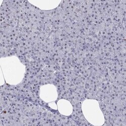 CD3 epsilon Antibody, Novus Biologicals 0.1mL; Unlabeled:Antibodies, Polyclonal