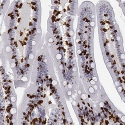 CD3 epsilon Antibody, Novus Biologicals 0.1mL; Unlabeled:Antibodies, Polyclonal