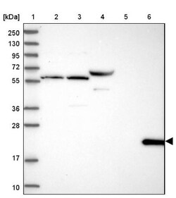 CD3 epsilon Antibody, Novus Biologicals 0.1mL; Unlabeled:Antibodies, Polyclonal