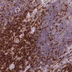 CD3 gamma Antibody, Novus Biologicals:Antibodies:Primary Antibodies