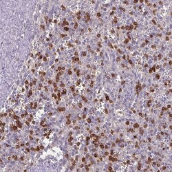 CD3 gamma Antibody, Novus Biologicals:Antibodies:Primary Antibodies