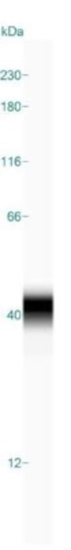 CD3 gamma Antibody, Novus Biologicals:Antibodies:Primary Antibodies