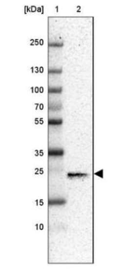 CD3 gamma Antibody, Novus Biologicals:Antibodies:Primary Antibodies